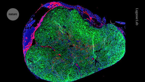 ‘Mini liver’ will grow in person’s own lymph node in bold new trial | Immunology and Biotherapies | Scoop.it