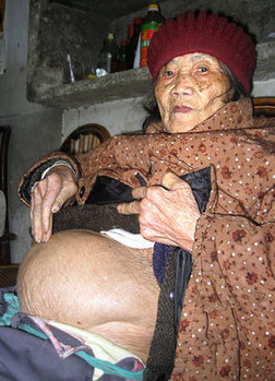 Une femme de 92 ans donne naissance à un bébé pétrifié | Chine | Scoop.it