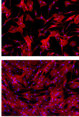 Rapid Formation of Mineralized Bone Tissue Based on Stem Cell-mediated Osteogenesis | iBB | Scoop.it