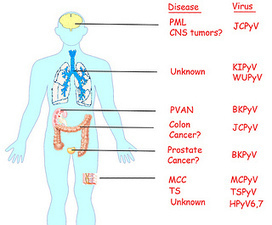 The Rapidly Expanding Family of Human Polyomaviruses | Virology News | Scoop.it