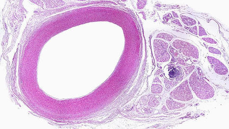 'World's Healthiest Arteries' Found to Be the Most Elastic | BEST OF PHARMAGEEK | Scoop.it