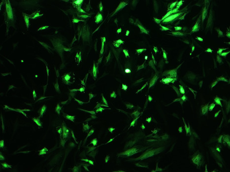 Manufacturing of Therapeutic Exosomes | iBB | Scoop.it