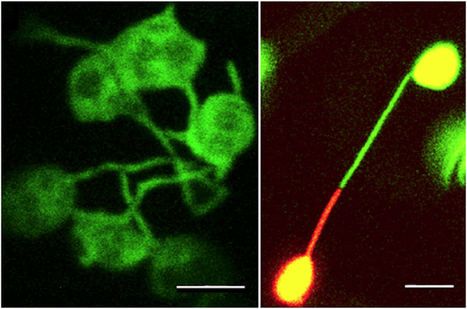 Differential Coloring Reveals That Plastids Do Not Form Networks for Exchanging Macromolecules | Plant Cell Biology and Microscopy | Scoop.it