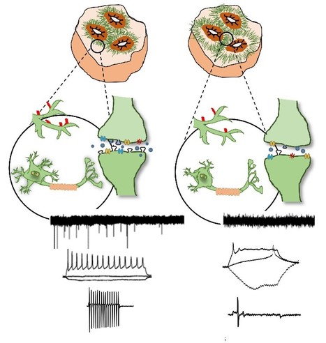 Modeling Rett Syndrome with Human Pluripotent Stem Cells: Mechanistic Outcomes and Future Clinical Perspectives | iBB | Scoop.it