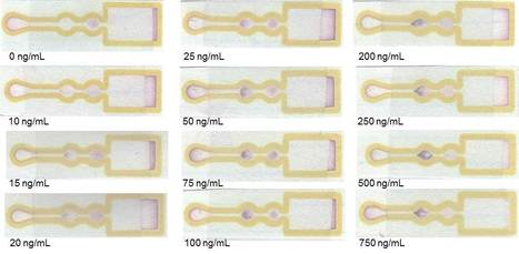 Colorimetric Detection of D-dimer in a Paper-based Device | iBB | Scoop.it