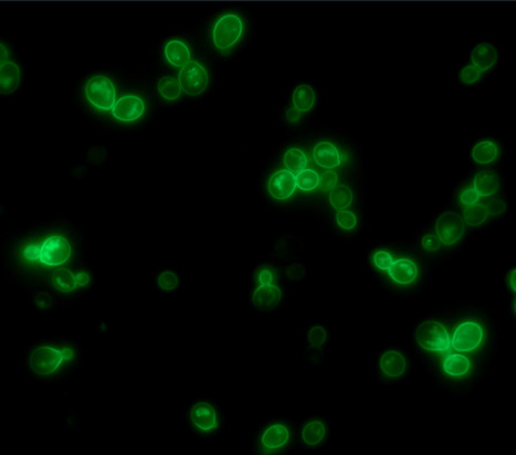 A new family of azole importers is uncovered by following the genomic evolution towards azole resistance in Candida glabrata | iBB | Scoop.it