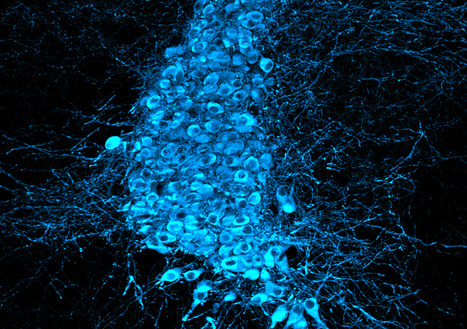 Maladie de Charcot : une nouvelle piste pour améliorer le diagnostic et le suivi des patients | RééDOC  - IRR Nancy : Actualités en Médecine Physique et de Réadaptation (MPR) - UGECAM Nord-Est | Scoop.it