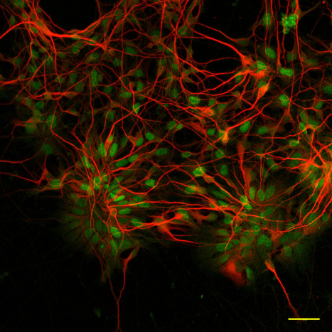 Cerebellar Organoids for Ataxia Research | iBB | Scoop.it