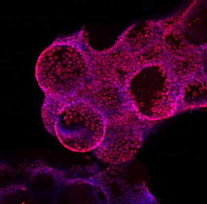 Expansion and Harvesting Of Human Induced Pluripotent Stem Cells on Dissolvable Microcarriers | iBB | Scoop.it