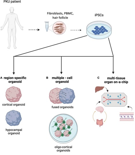 Engineering Organoids for Modeling PKU | iBB | Scoop.it