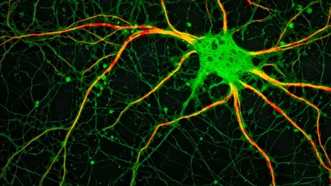 Le cerveau sur écoute grâce à l’IRM de diffusion | Life Sciences Université Paris-Saclay | Scoop.it