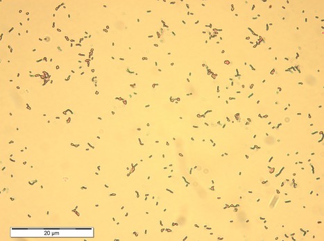 Lactic Acid Bacterial Factories | iBB | Scoop.it