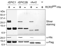 PNAS: Apoplastic effectors secreted by two unrelated eukaryotic plant pathogens target the tomato defense protease Rcr3 | Plants and Microbes | Scoop.it