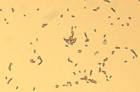 The Effect of Recombinant Protein Production in Lactococcus lactis Transcriptome and Proteome | iBB | Scoop.it