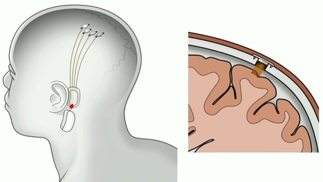 Chip allowing Brain-Computer Communication to come 'before the end of next year' - Elon Musk | Information Technology & Social Media News | Scoop.it