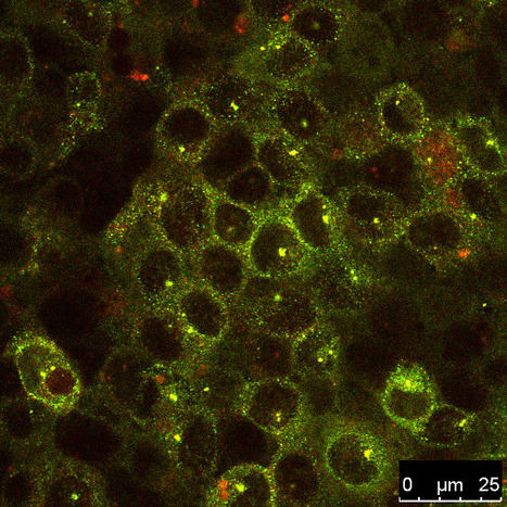 BcaA Adhesin Binds TNFR1 and Contributes to Induce Airway Inflammation | iBB | Scoop.it