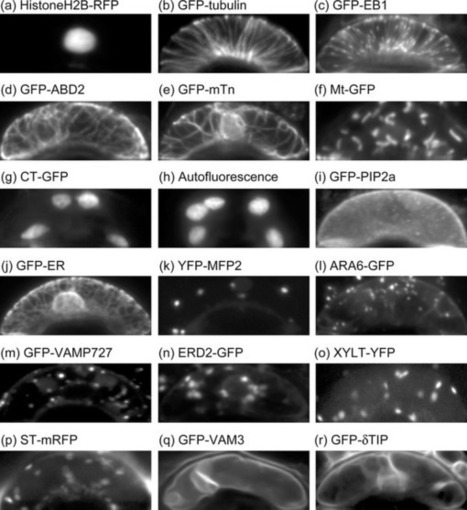 Statistical organelle dissection of Arabidopsis guard cells using image database LIPS : Scientific Reports : Nature Publishing Group | Plant Cell Biology and Microscopy | Scoop.it