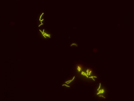 Adaptive Response of Rhodococcus opacus PWD4 to Salt and Phenolic Stress at the Level of Mycolic Acids | iBB | Scoop.it