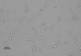 Engineering Human MSC with VEGF-encoding Minicircles for Angiogenic Gene Therapy | iBB | Scoop.it