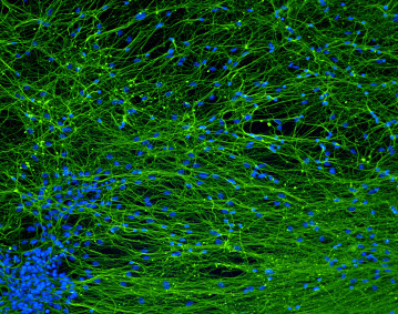 Control of Aggregation Directs Human Pluripotent Stem Cells Towards Neural Commitment | iBB | Scoop.it