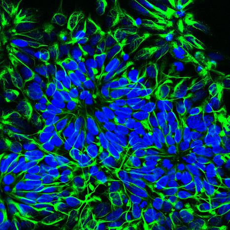 Neural Induction of Human Induced Pluripotent Stem Cells for Neurodevelopmental Toxicity Studies | iBB | Scoop.it