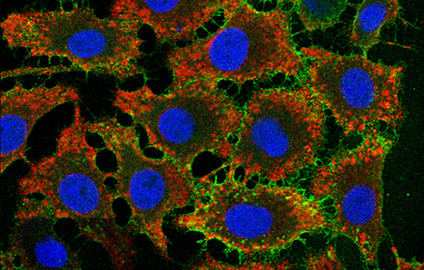 Virus de la stomatite vésiculaire : entrée dans les cellules décryptée | Life Sciences Université Paris-Saclay | Scoop.it