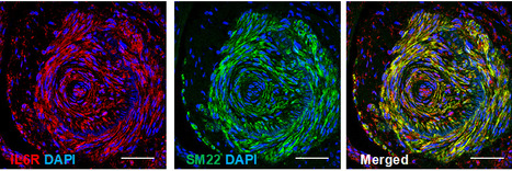 Le récepteur à l’IL6 (IL6R), une pierre angulaire entre inflammation et remaniement vasculaire dans l’Hypertension Artérielle Pulmonaire (HTAP) | Life Sciences Université Paris-Saclay | Scoop.it