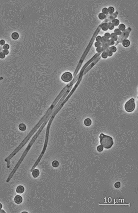 Characterization of a New Blastobotrys navarrensis Strain | iBB | Scoop.it