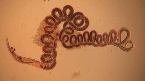 How parasitic worms could help us with everything from obesity to asthma | Longevity science | Scoop.it