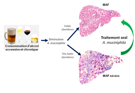 Le microbiote intestinal, cofacteur de la sévérité dans la maladie alcoolique du foie, comme nouvelle cible thérapeutique : Akkermansia muciniphila sur le devant de la scène | Life Sciences Université Paris-Saclay | Scoop.it