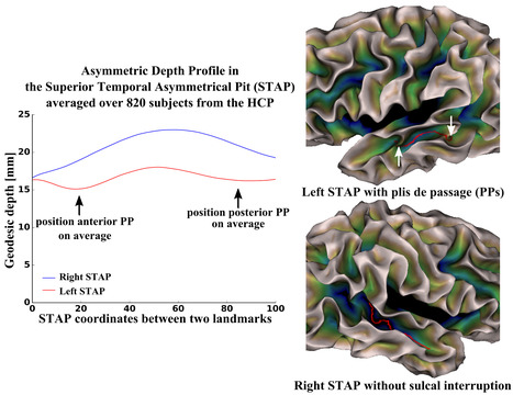 The chaotic morphology of the left superior temporal sulcus is genetically constrained | Life Sciences Université Paris-Saclay | Scoop.it