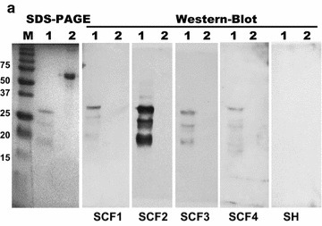 The OmpA-like Protein BCAL2958 is a Potential Candidate for Preventive Therapies of B. cepacia Complex-Infected Cystic Fibrosis Patients | iBB | Scoop.it