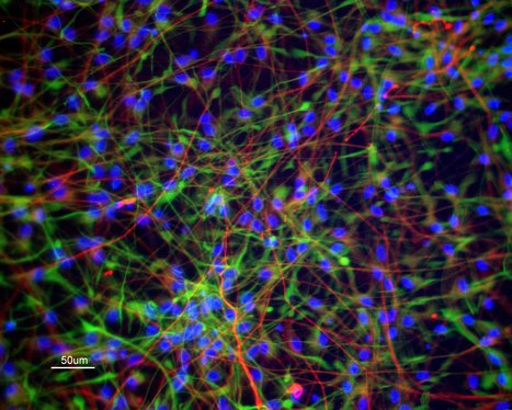 Electrical Stimulation of Neural Stem Cells on Electroconductive Platforms Made of PEDOT:PSS | iBB | Scoop.it