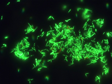 Production of PUFAs in a Gram-positive Bacteria | iBB | Scoop.it