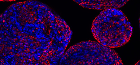 Scale-up of Cardiomyocyte Production | iBB | Scoop.it