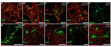 Maturation of Human Pluripotent Stem Cell-Derived Cerebellar Neurons in the Absence of Co-Culture | iBB | Scoop.it