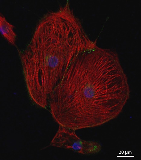 Transcriptomic Analysis of 3D Cardiac Differentiation of Human Induced Pluripotent Stem Cells | iBB | Scoop.it