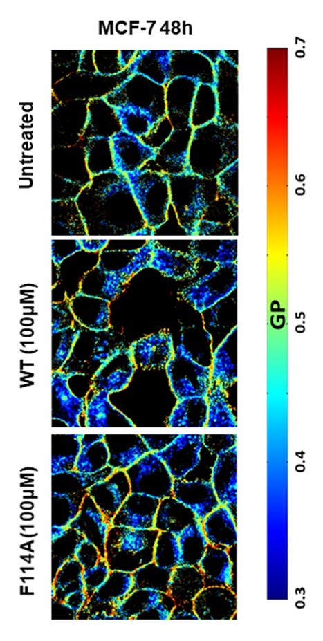 Azurin Perturbs Lipid Rafts’ Organization and Enhances Sensitivity to Anti-cancer Drugs | iBB | Scoop.it