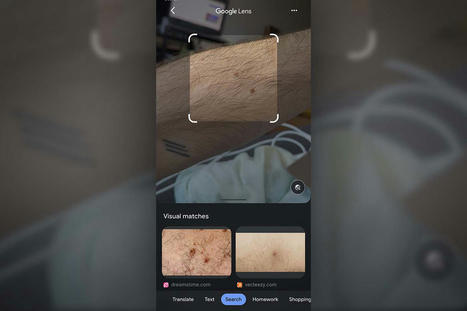 Comment utiliser Google Lens pour diagnostiquer vos grains de beauté ? | M-HEALTH  By PHARMAGEEK | Scoop.it